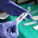 Cutting to the Chase – Pros and Cons of Home Testing for HIV
